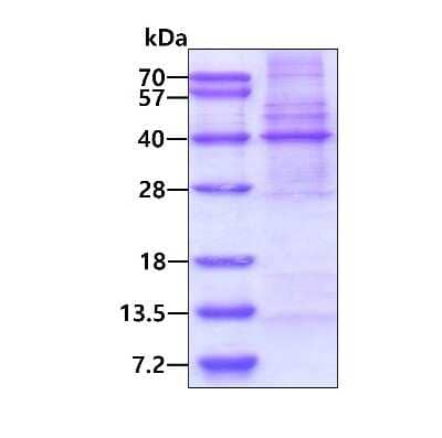 SDS-Page: Recombinant Human MLF1 Interacting Protein His Protein [NBP2-23247] - 3ug by SDS-PAGE under reducing condition and visualized by coomassie blue stain.